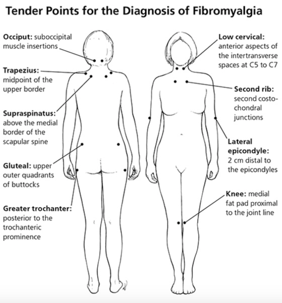 Pleasure points of a woman